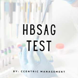 HBSAG Test