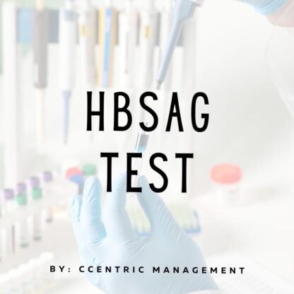 HBSAG Test
